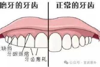 咯吱咯吱...老磨牙是怎么回事？