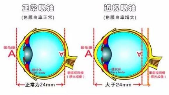 必看！近视防控10个误区！这么做就把眼睛耽误了→