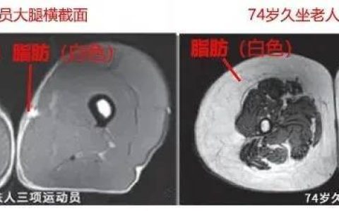 运动是加速衰老，还是延缓衰老？真相揭开！