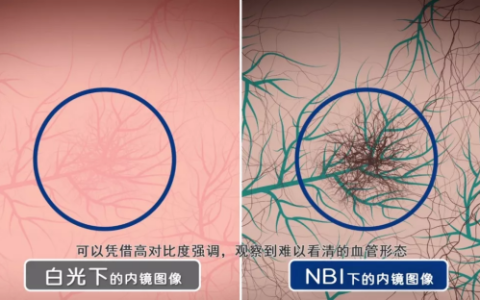 新年健康计划第一步，不妨从关爱家人肠胃健康开始