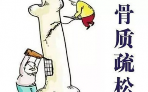 骨质疏松性骨折 中医治疗原则