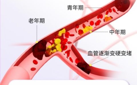 糖尿病患者达5.37亿！并发症不可小觑！UBIO优碧欧黑蒜铬片糖脂双效全面对抗并发症