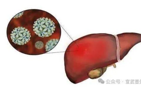 当冰箱变身生化武器库：一勺霉酱=20口砒霜？