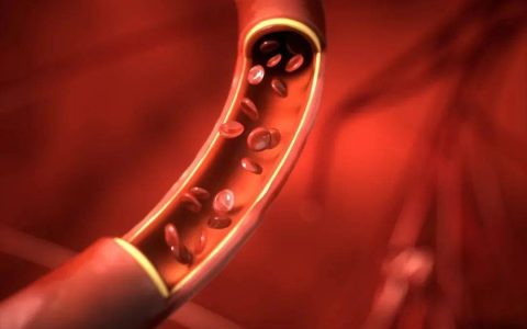 晨起后有这3种表现，你的血管可能不健康