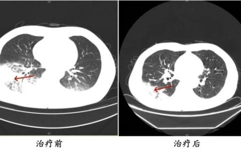 一年未开的空调启用在即，专家重要提醒