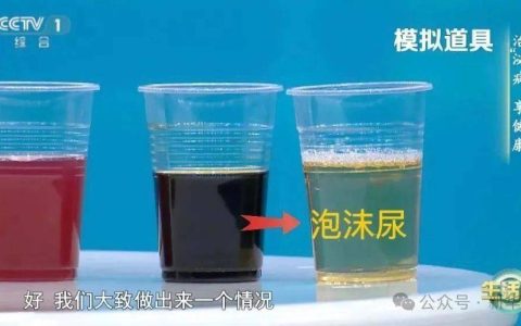 喝水后4个异常，可能是肾发出的“求救信号”！