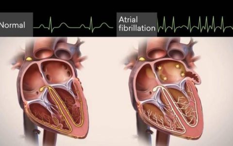 怦怦乱跳的“小心脏”，我该拿你怎么办？