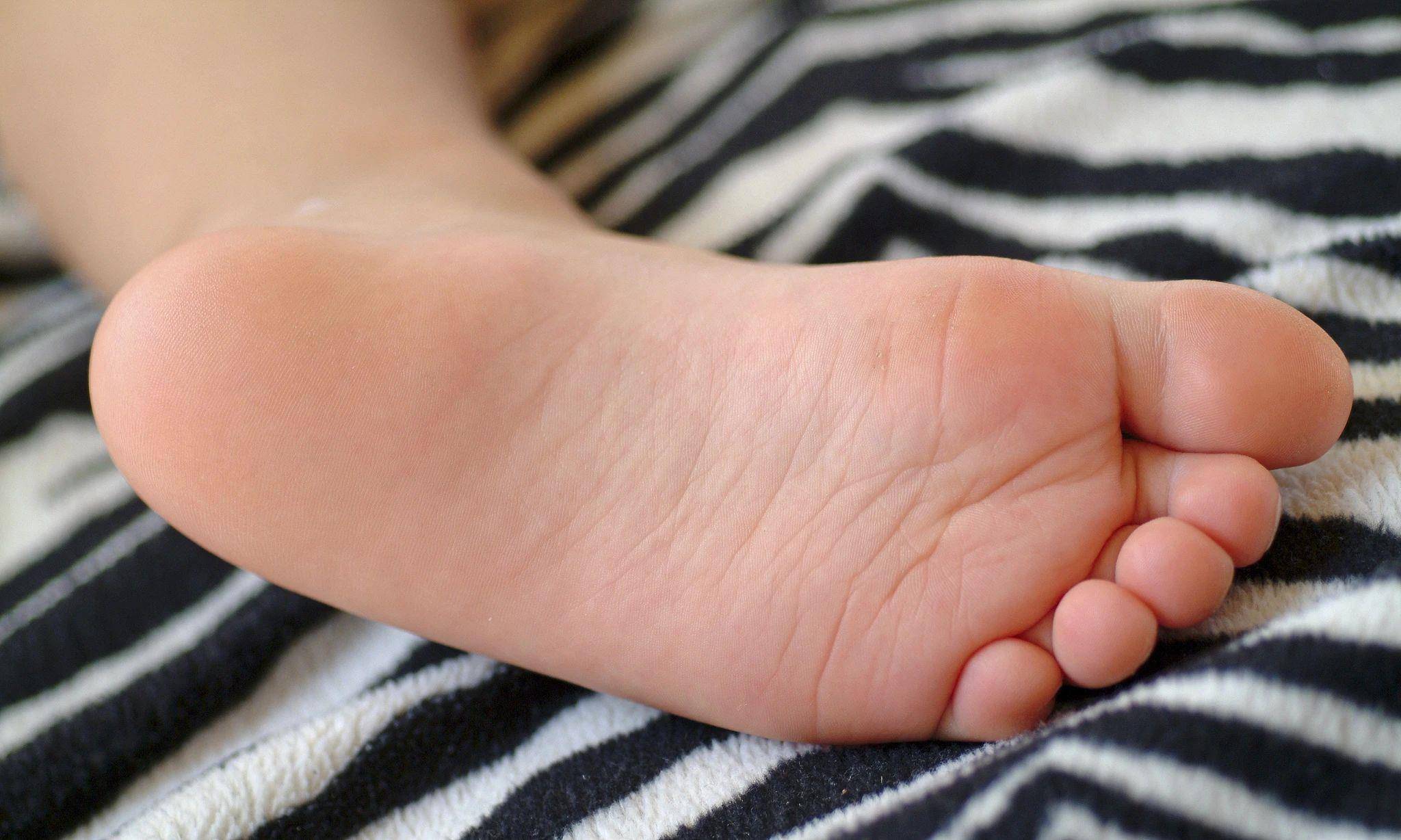 双脚有这4个特征的人更健康长寿 看看你有吗？插图4