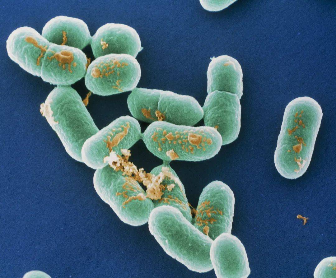 冰箱里的肉最多能“冻”多久？这组数字快记好→插图