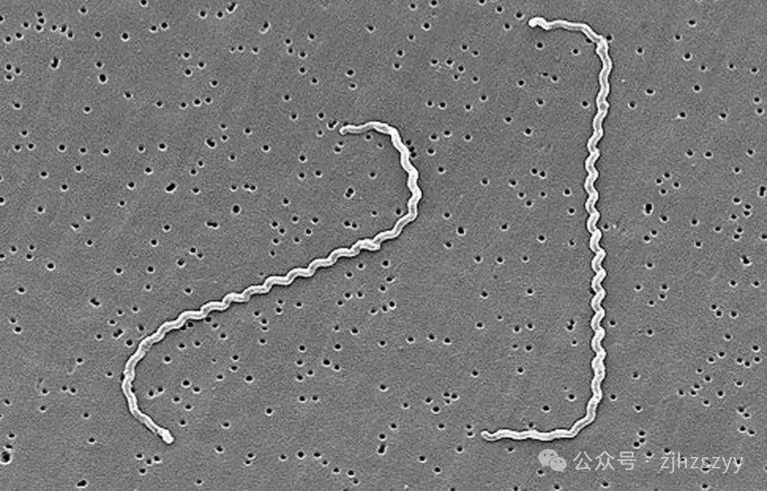 10秒感染，男子高烧42℃险丧命！人人可能中招插图2