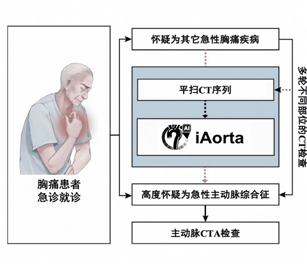 全球首款！浙大一院、阿里发布主动脉急诊AI模型：准确率高达99.4％插图4