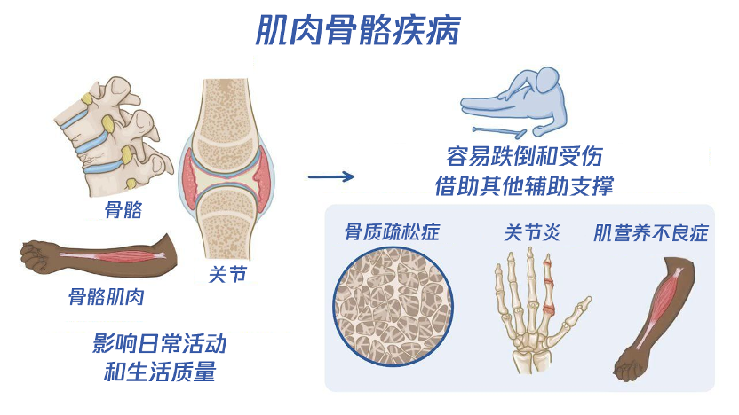 主导起草国家标准，米乔人体工学携手国标院重塑肌肉骨骼健康管理新范式插图2