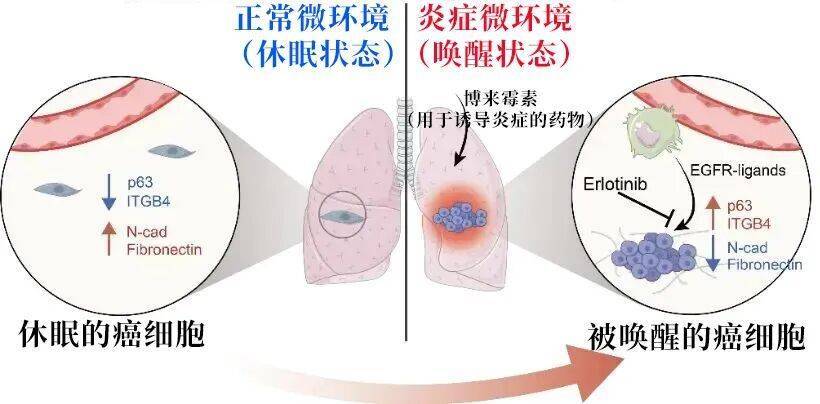 长期炎症会“唤醒”癌细胞！这份抗炎指南每个人都该看看插图