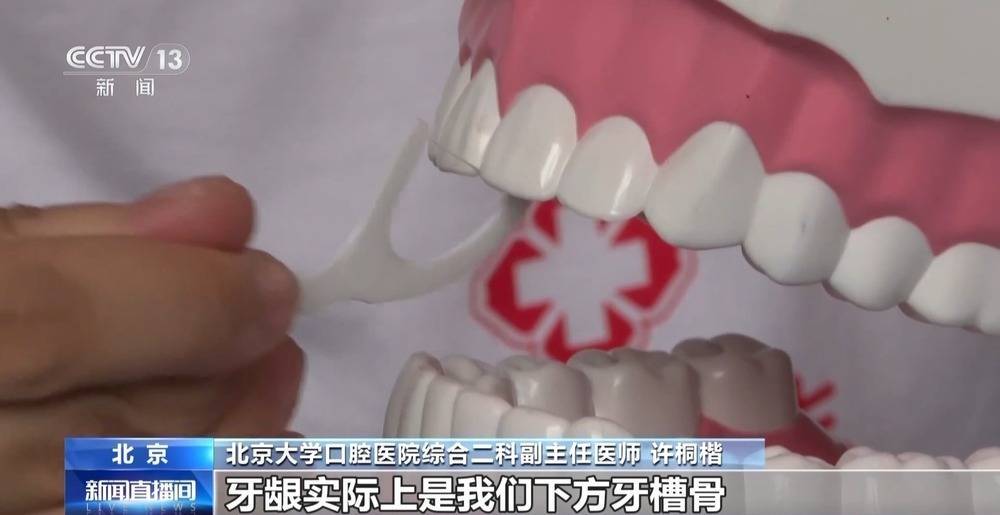 洗牙会造成牙龈退缩？“老掉牙”不可避免？这些健康误区要注意插图6