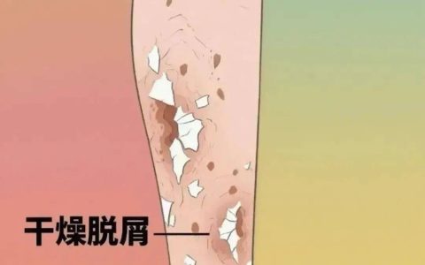 身体发出这3个信号，可能是血糖在“报警”，一定要当心！