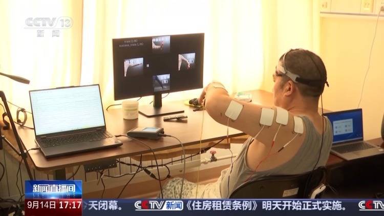 什么样的患者适合手术？如何进行康复训练？探访我国首个脑机接口病房插图