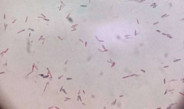 注意！毒性是砒霜的1000万倍！很多人家有，赶紧自查→插图4