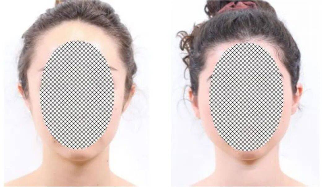 吃错碳水真的会变丑！还有这些“隐形伤害”……插图4