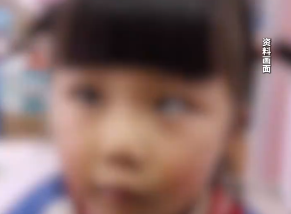 5岁女童沉迷玩手机变“斗鸡眼” 日均玩手机4至5小时