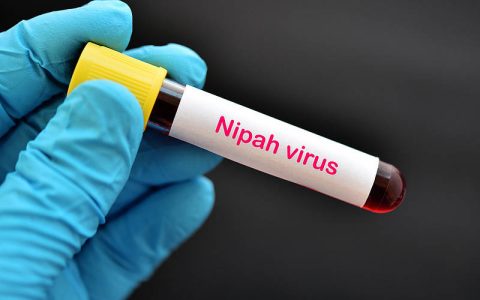 尼帕病毒怎样传播？如何提早预防？一文了解