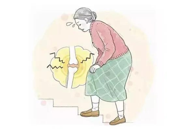 骨关节炎选药指南:理清盐酸和硫酸氨基酸葡萄糖胶囊的作用与功效插图2 骨关节炎选药指南:理清盐酸和硫酸氨基酸葡萄糖胶囊的作用与功效插图2