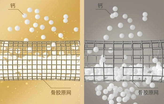 别让脆性骨折偷走晚年尊严，揭秘长寿老人的骨骼“韧性”密码——骨胶原钙插图1