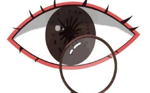 确诊干眼症，需要做哪些检查？