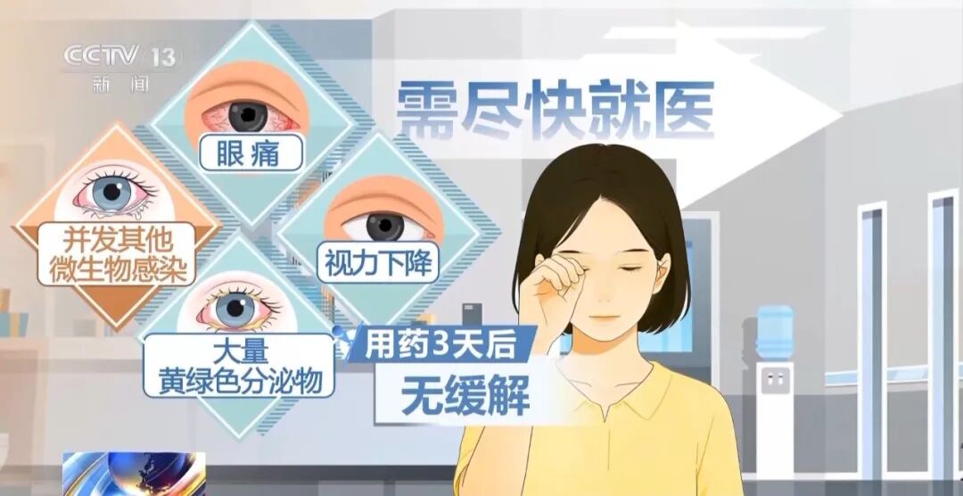 应对春季角结膜炎：别乱用药，先避敏——尖峰眼科提示插图5