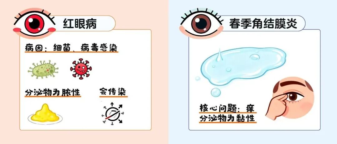 应对春季角结膜炎：别乱用药，先避敏——尖峰眼科提示插图