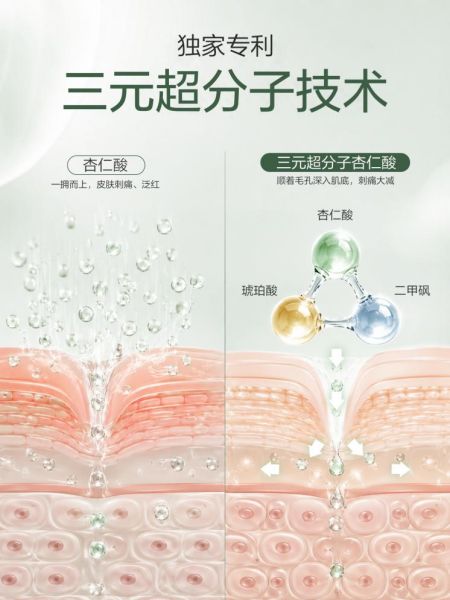 凡可杏仁酸精华液3.0重磅上市:三元超分子技术,让刷酸更温和、效果更出众插图2 凡可杏仁酸精华液3.0重磅上市:三元超分子技术,让刷酸更温和、效果更出众插图2