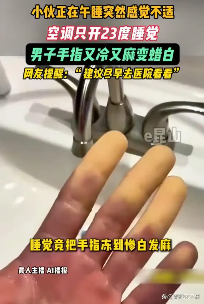男子空调房午睡手指冻至惨白发麻，医生提醒警惕“雷诺现象”插图
