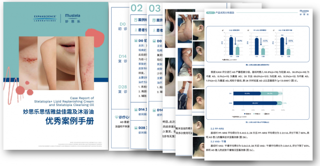 妙思乐：循证守护婴童肌肤健康，以全球科研沉淀深耕中国AD