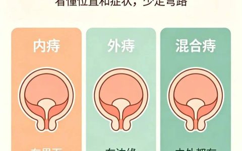 别难以启齿！关于痔疮，你需要知道这些